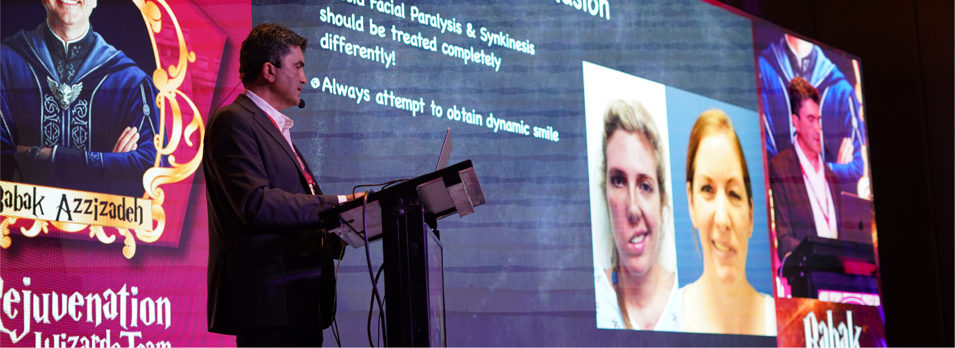 deep-plane-cirugia-plastica-facial-001